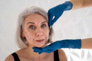hilos tensores tratamiento flacidez facial Miami.