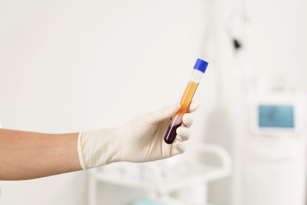 Aislamiento de plasma rico en plaquetas para tratamiento P-Shot en Miami