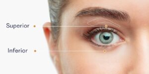 blefaroplastia superior e inferior